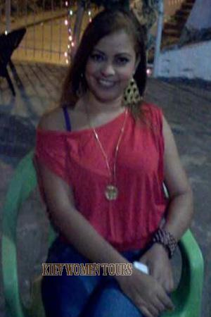 170304 - Claudit Age: 49 - Colombia